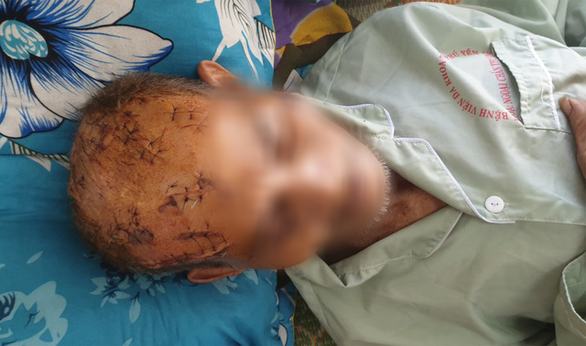 Nghi án cụ ông 74 tuổi bị con trai, cháu nội chém nhiều nhát: Bất ngờ lời khai người trong cuộc