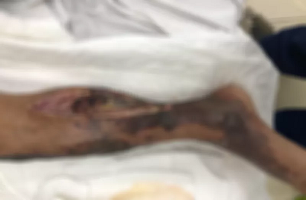 Tin tức đời sống mới nhất ngày 2/5/2020: Suýt mất mạng vì ăn gỏi cá rô phi nhiễm 'tả biển'