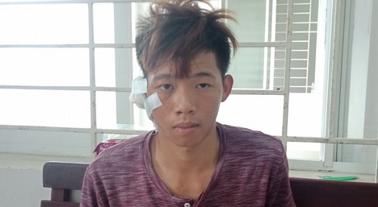 Lộ nguyên nhân thiếu niên 17 tuổi dùng dao đâm chết bạn tại cuộc nhậu