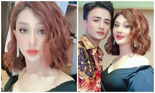 Sửng sốt trước gương mặt nhọn hoắt khác lạ của Lâm Khánh Chi