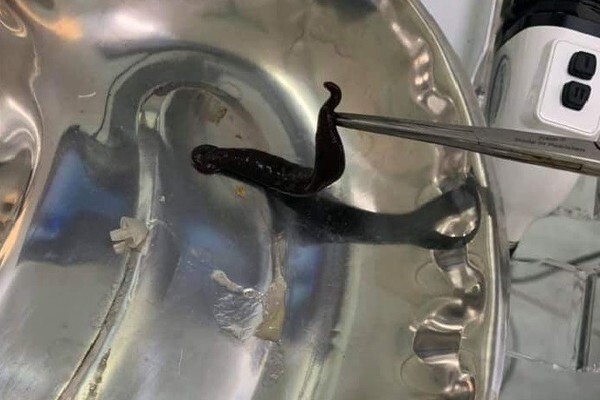 Hãi hùng đỉa dài gần 10cm