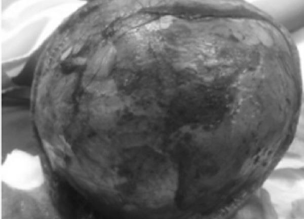 Tin tức đời sống mới nhất ngày 25/5/2020: Bé gái bị máy xay nước đá cuốn tóc lột hết da đầu