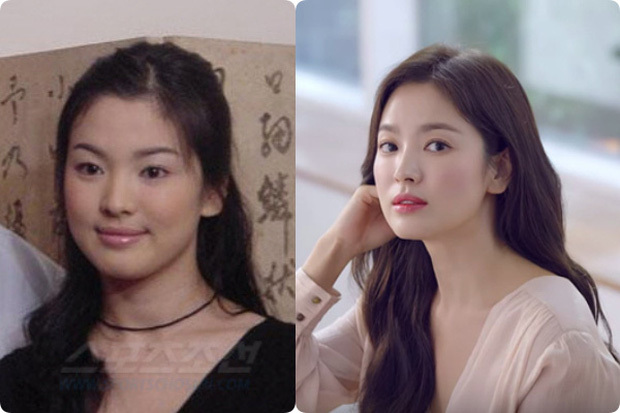 Tượng đài nhan sắc Song Hye Kyo gây sốc với loạt ảnh mặt tròn xoe, nặng tới 70kg cách đây 20 năm
