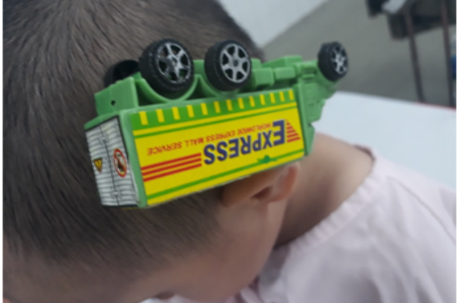 TP.HCM: Cấp cứu cho bé trai bị xe đồ chơi cắm vào đầu