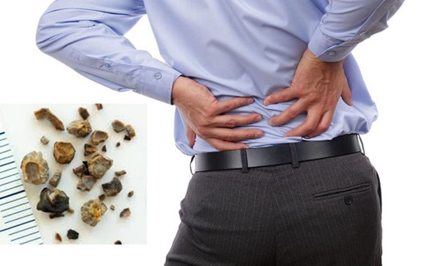Quý ông phải trả giá đắt vì tin lời người quen uống thuốc Nam chữa bệnh