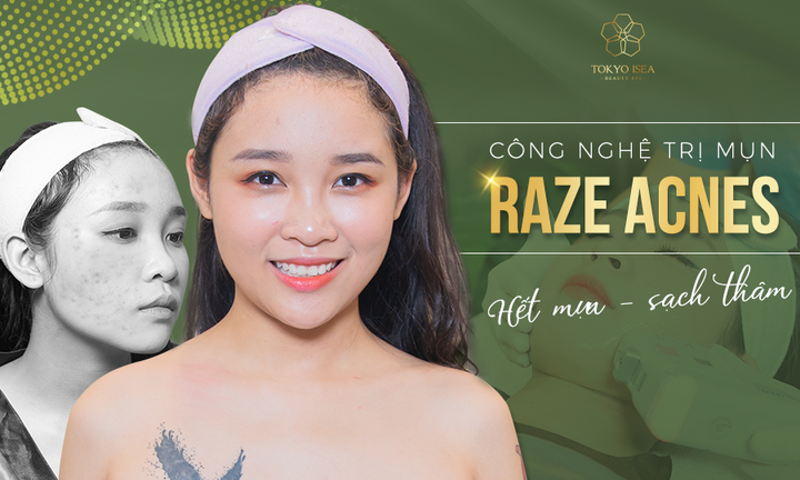 Dịch vụ chăm sóc da mặt tại Viện thẩm mỹ TOKYO ISEA 