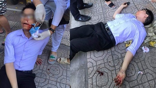 Tin tức pháp luật mới nhất ngày 28/6/2020: Diễn biến mới vụ cán bộ tư pháp ở Thái Bình bị đánh