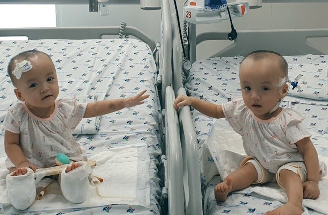Tin tức đời sống mới nhất ngày 19/8/2020: Song Nhi lần đầu chạm tay nhau sau ca mổ tách rời