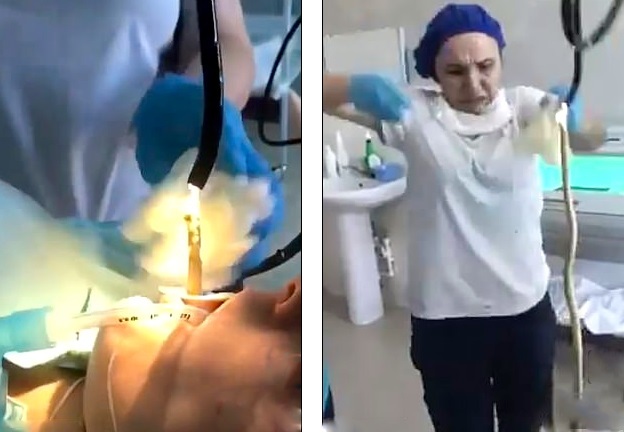 Video: Rợn người cảnh bác sĩ lôi con rắn dài 1,2m ra khỏi họng nữ bệnh nhân