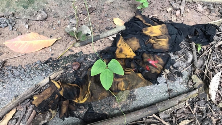 Vụ thiếu nữ 15 tuổi nghi bị bạn trai tẩm xăng đốt: Nạn nhân bỏng 95% cơ thể