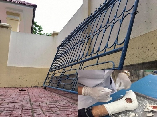 Nghệ An: Đang chơi đùa với bạn, bé lớp 3 bị cổng sắt của trường đổ sập đè lên chân