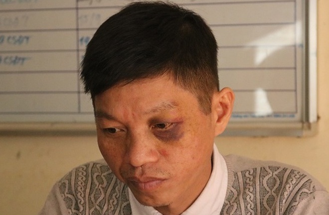 Đang làm nhiệm vụ, Thượng úy công an bị tài xế xe máy tông trực diện 