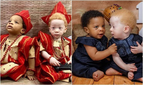 Chào đời cách nhau vài phút, cặp song sinh lại có điểm khác biệt đến ngỡ ngàng