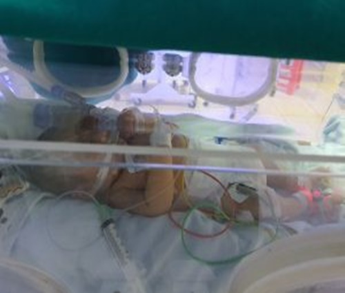 Tin tức đời sống ngày 11/1: Bé 9 ngày tuổi nguy kịch do bị uốn ván