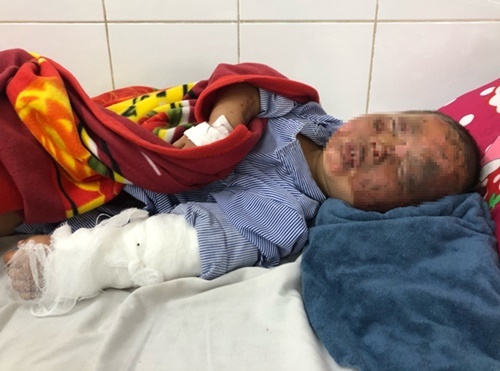 Tin tức đời sống ngày 12/2: Bé 3 tuổi bị bỏng nặng do pháo tự chế phát nổ