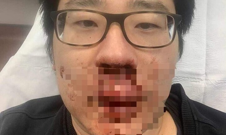Nam giảng viên Trung Quốc bị tấn công giữa ban ngày ở Anh, lý do khiến nhiều người phải lo ngại