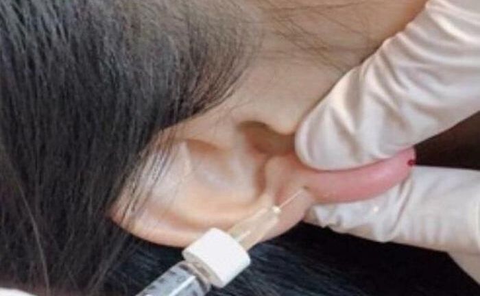 Đổ xô đi tiêm