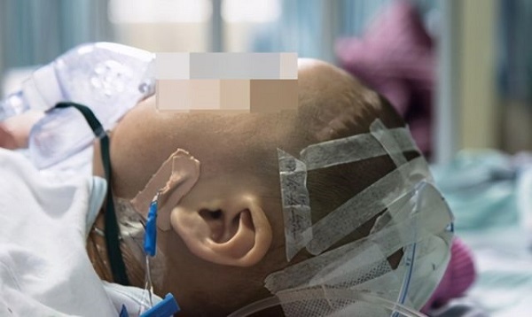 Bé 7 tháng tuổi ngã từ trên giường xuống đất nhưng không kêu không khóc, vài ngày sau đột ngột tử vong