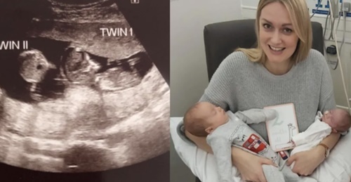 Kỳ lạ bé gái bất ngờ có bạn 