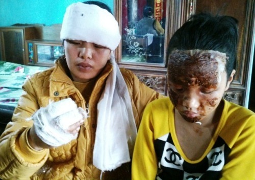 Toàn cảnh vụ 
