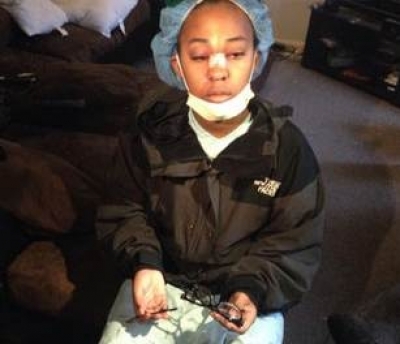 Thoát chết thần kỳ nhờ… đeo mắt kính