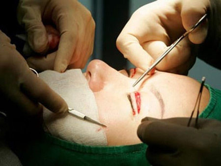 Phẫu thuật thẩm mỹ - “cơn ác mộng” ở Hàn Quốc