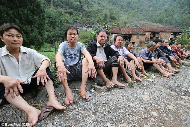 Cả ngôi làng hoang mang vì mắc bệnh lạ