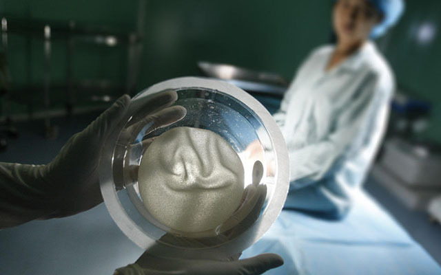 Cô gái quyết tâm nâng ngực để... tìm người yêu