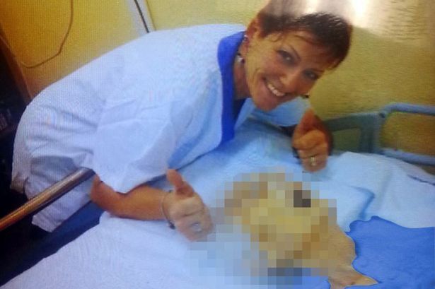 Phẫn nộ bức ảnh nữ y tá tạo dáng tươi cười bên tử thi