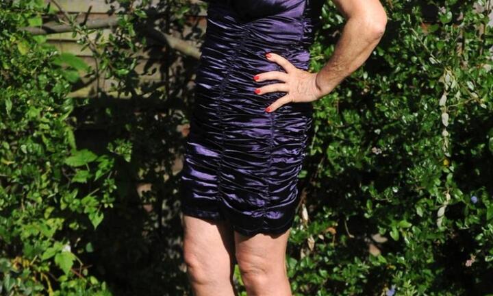 Góa phụ 73 tuổi phẫu thuật thẩm mỹ để “dụ dỗ” đàn ông