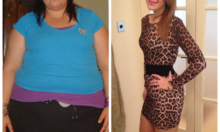 Cô gái giảm gần 80 kg để được 