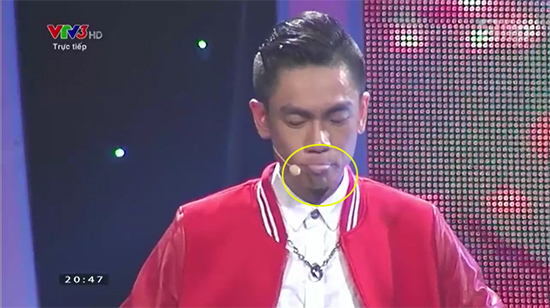 Xử trí như thế nào sau khi uống nhầm axit?