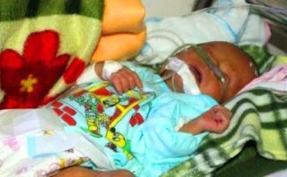 Sức khỏe bé trai bị đẻ rơi xuống bồn cầu có dấu hiệu xấu