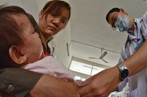 Cách điều trị bệnh sởi