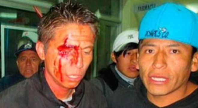 Sút hỏng 11m, sao Peru bị CLB thuê người hành hung dã man