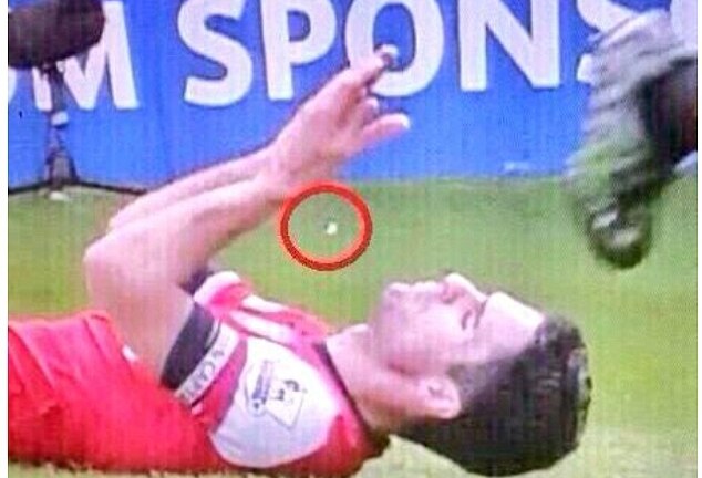 Va chạm cực mạnh, Mikel Arteta gẫy hai chiếc răng cửa