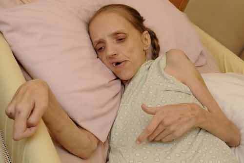 Bà mẹ nghiện rượu, đang đối mặt với cái chết ở tuổi 35