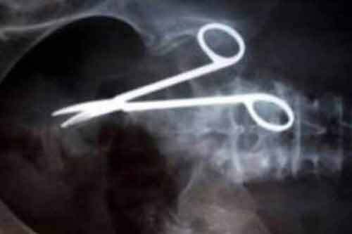 Bệnh nhân sống với chiếc kéo trong dạ dày suốt 9 năm