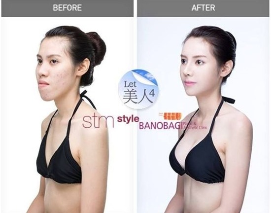 Cuộc “lột xác” của cô gái có gương mặt “Khỉ đột”