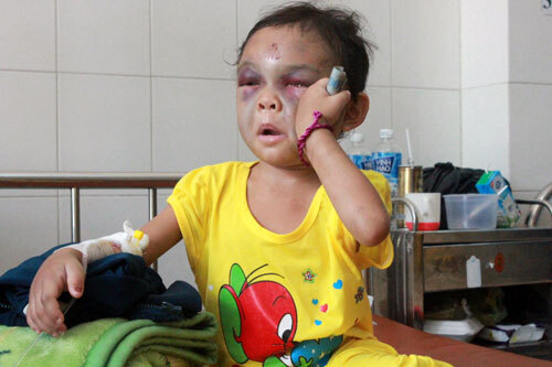 Xót xa hình ảnh bé 4 tuổi bị cha mẹ đánh đập như thời trung cổ