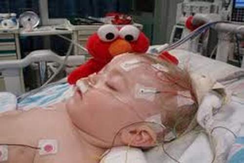 Triệu chứng và cách phòng bệnh viêm não Nhật Bản 