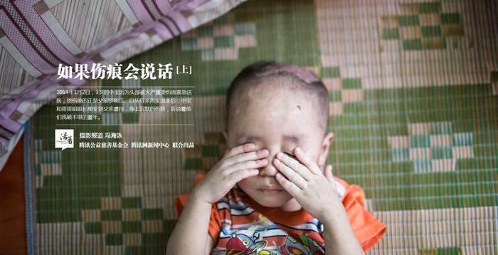 Chùm ảnh rúng động về 3 em bé bị chính cha đẻ bạo hành