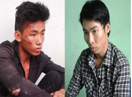 TPHCM: Bị cướp Iphone, cô gái ngã chấn thương sọ não