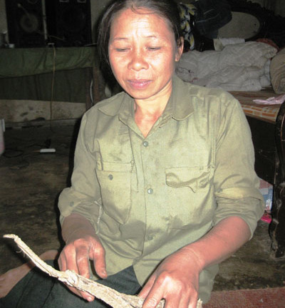 Bài thuốc giúp hàng ngàn người bị chó dại cắn “chết đi sống lại”