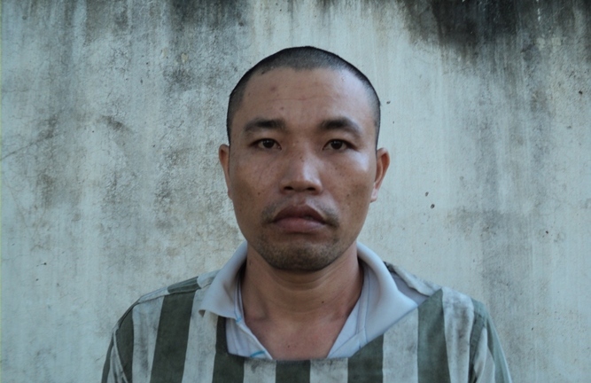 Bắt đối tượng đánh kẻ trộm  chim chấn thương sọ não