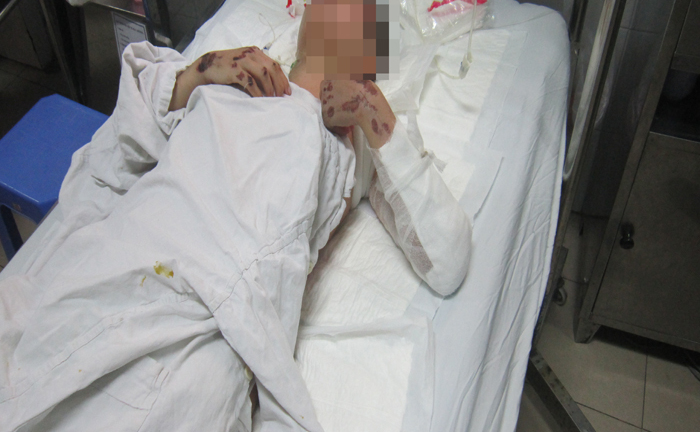 Sức khỏe thai phụ bị kéo lê 50m có dấu hiệu tích cực