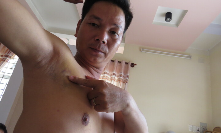 Bình Dương: Dân quân vừa đánh người vừa la làng?
