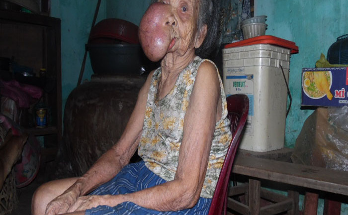 Nỗi bất hạnh cùng cực của người có khuôn mặt lạ