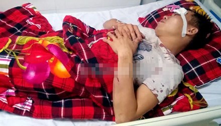 Gần 20 đối tượng xông vào nhà đánh đập, truy sát nam thanh niên