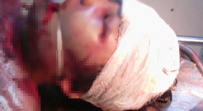 Vì chiếc điện thoại, kẻ trộm ra tay tàn độc với bé gái 14 tuổi?